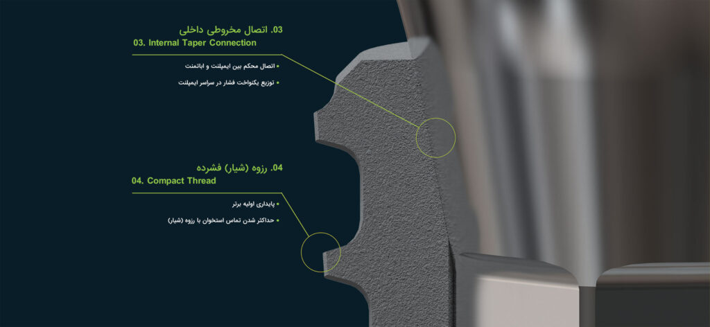 ایمپلنت Core1