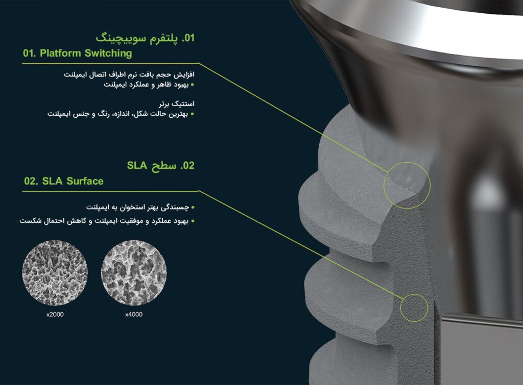 ایمپلنت Core1