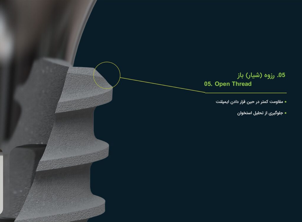 ایمپلنت Core1